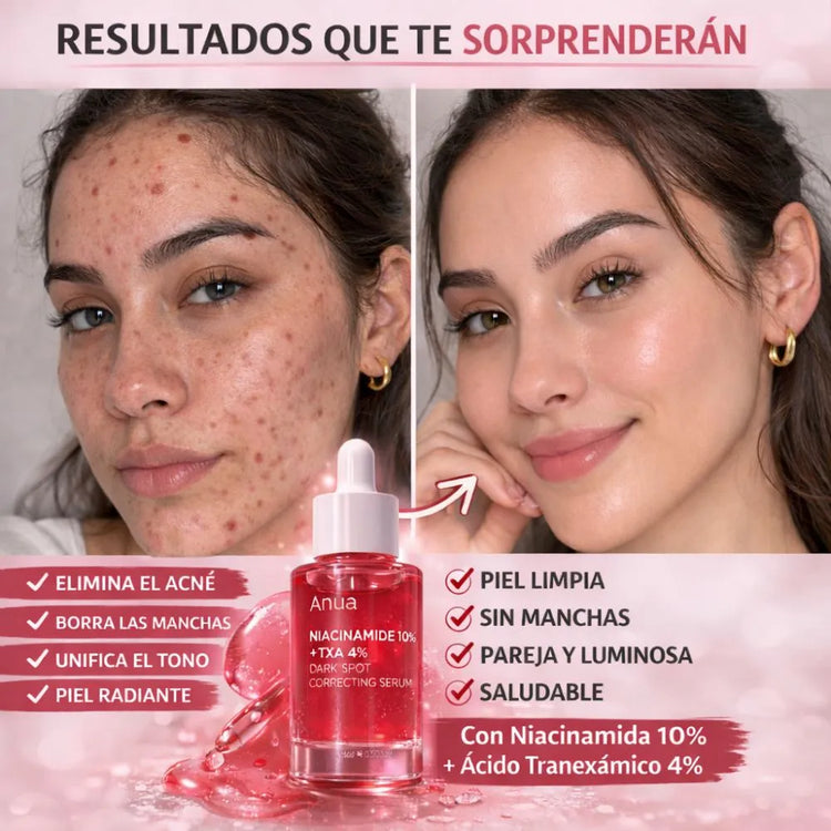 Sérum Facial Anti-Manchas ANUA - Niacinamida 10% + TXA 4% 🪞 💄 🌺