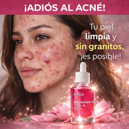 Sérum Facial Anti-Manchas ANUA - Niacinamida 10% + TXA 4% 🪞 💄 🌺