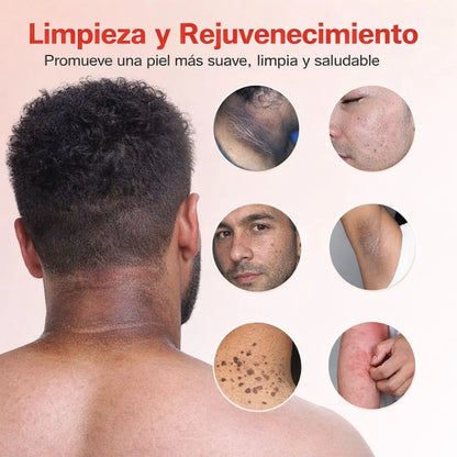 Gel Exfoliante QUARXERY - Eliminador de Células Muertas🫧✨🧴