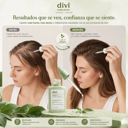Suero Para Cuero Cabelludo-DIVI Olvidate de La Caida de Cabello!