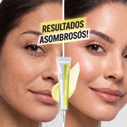 Retinal Shot Celimax - Ciencia Avanzada Para Una Piel Perfecta 🧬🧴💚